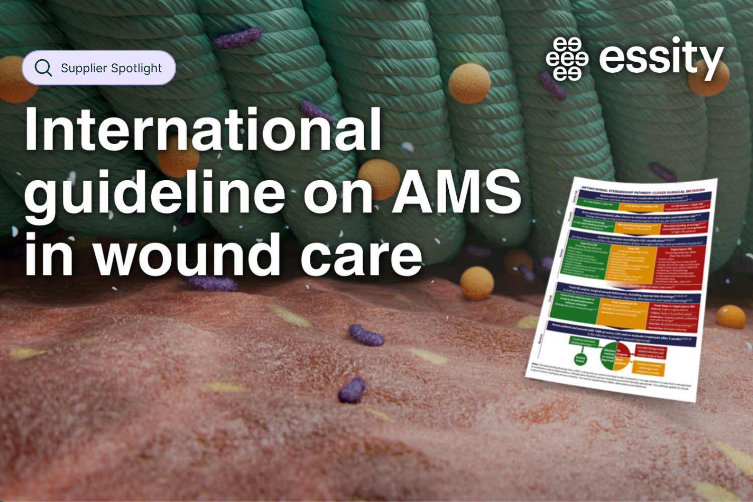 Supplier Spotlight: Advancing Antimicrobial Stewardship with Leukomed® Sorbact®